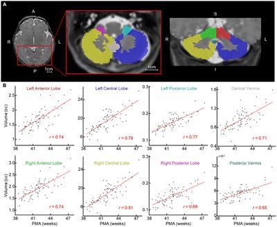 Cerebellar volume and functional connectivity in neonates predicts social and emotional development in toddlers